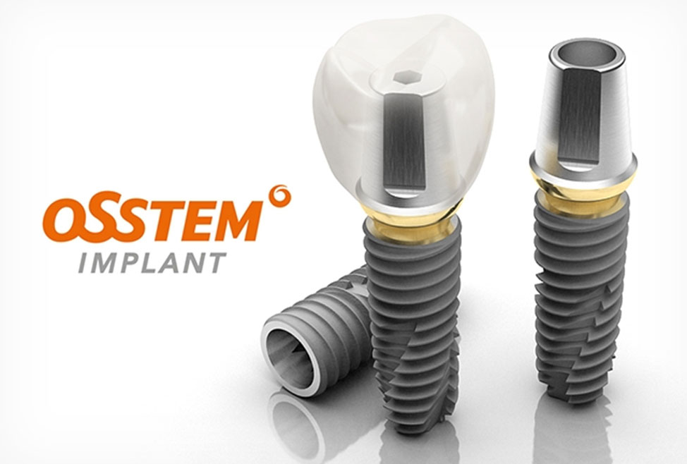 Osstem Implant ― чи варто довіряти бренду?