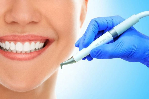 Професійна чистка зубів: необхідність для якісної гігієни ротової порожнини